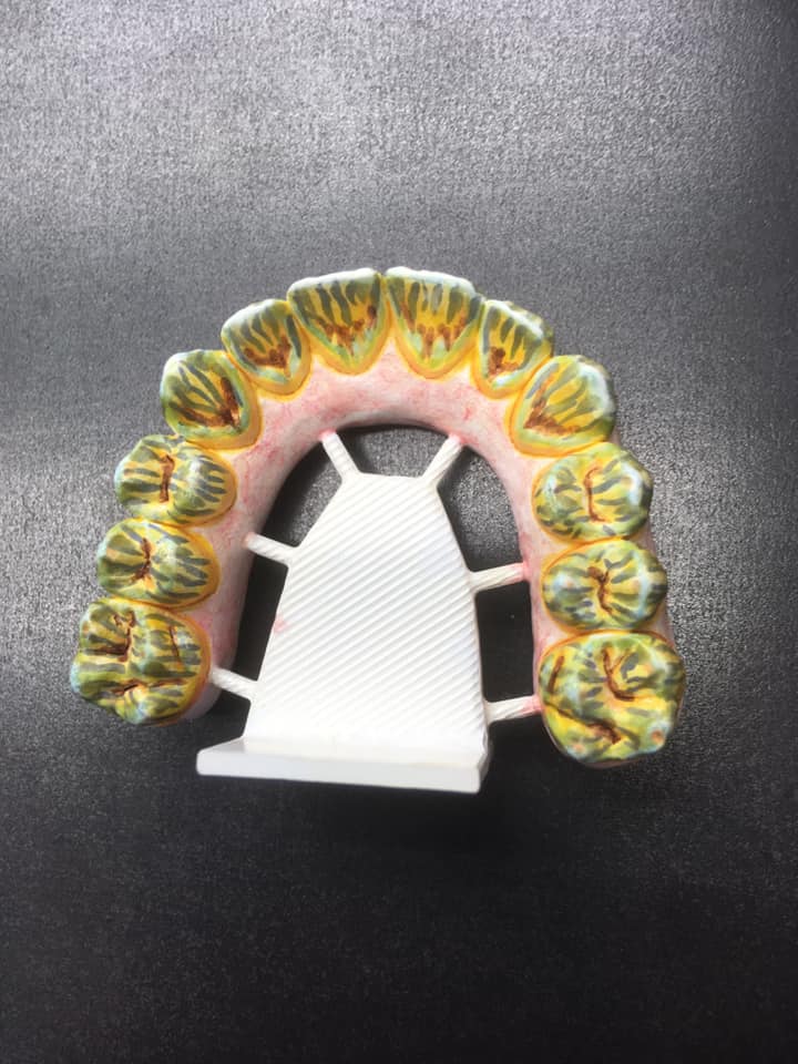 mould of inside of teeth