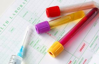 Drug Tests — Medical Specimens in Gary, Indiana Drug Tests — Medical Specimens in Gary, Indiana