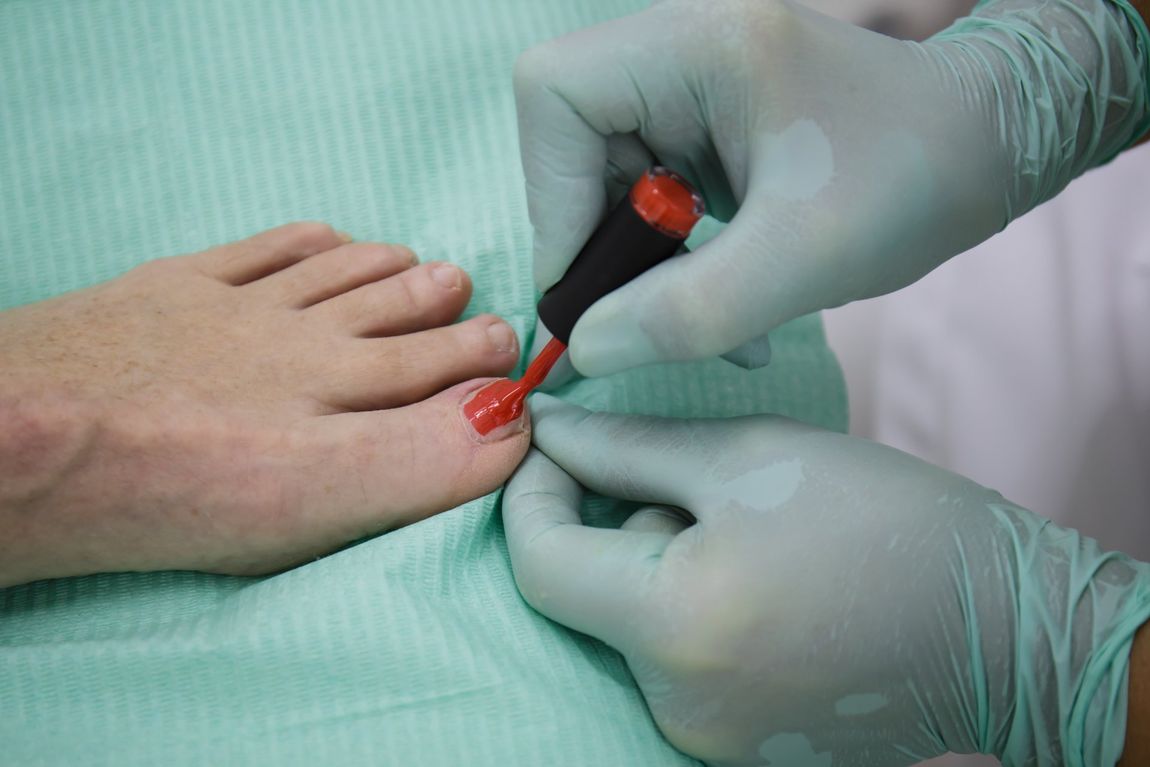 Gellac