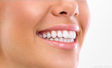 Veneers wurden in Hollywood erfunden
