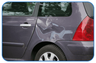 Car dent removal