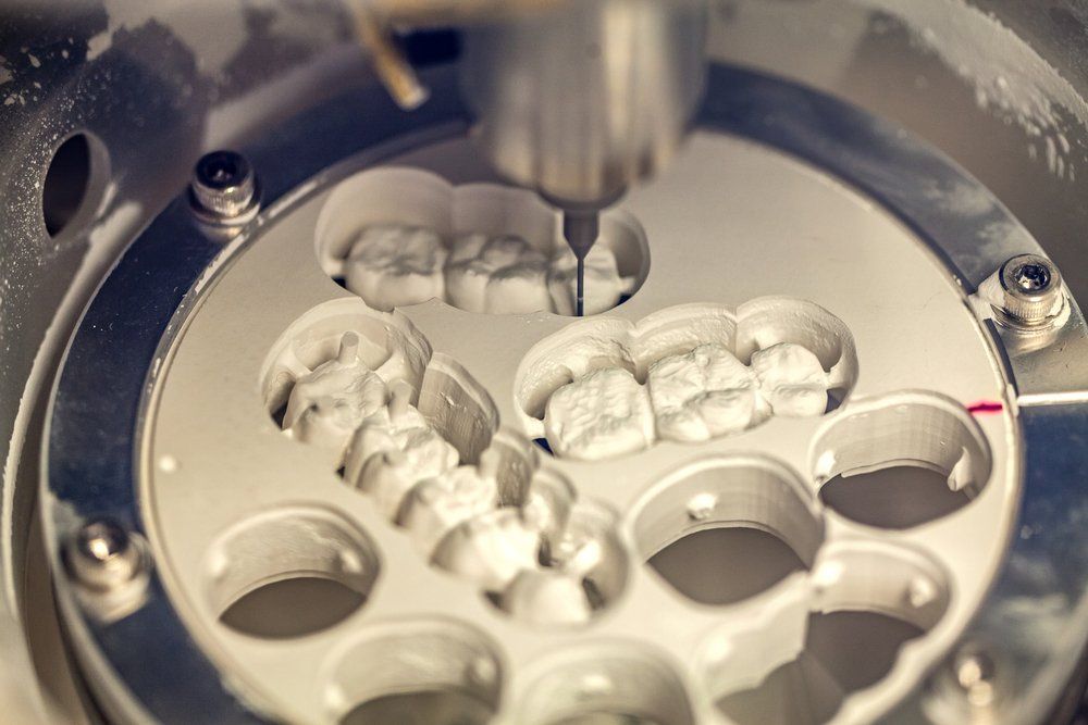 Zahnästhetik mit Keramik und Zirkonoxid