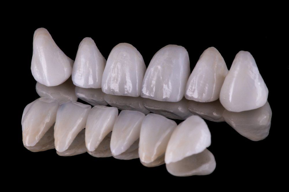 Zahnästhetik mit Keramik und Zirkonoxid