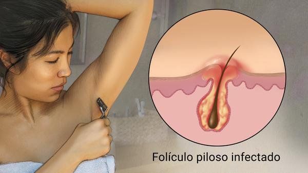 Una mujer se está afeitando la axila con una navaja.