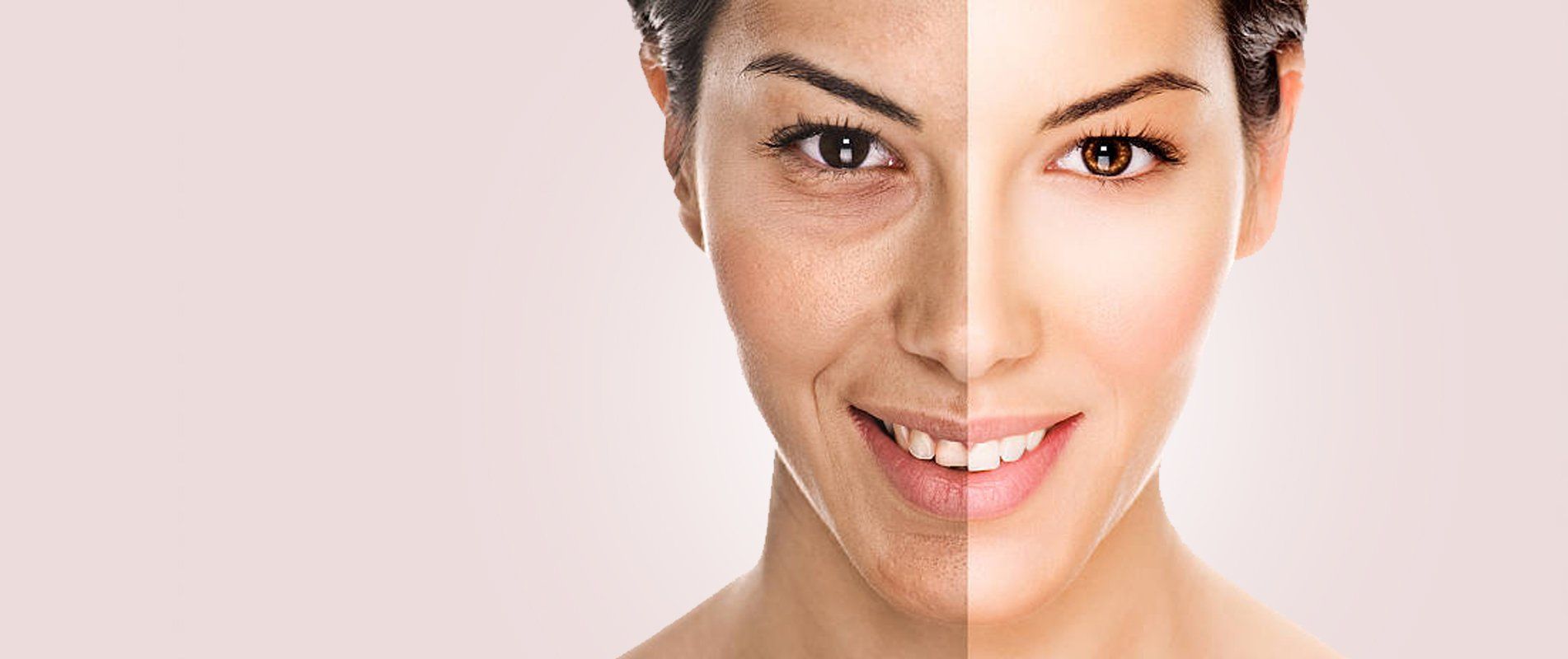 Se muestra el rostro de una mujer antes y después de un tratamiento.