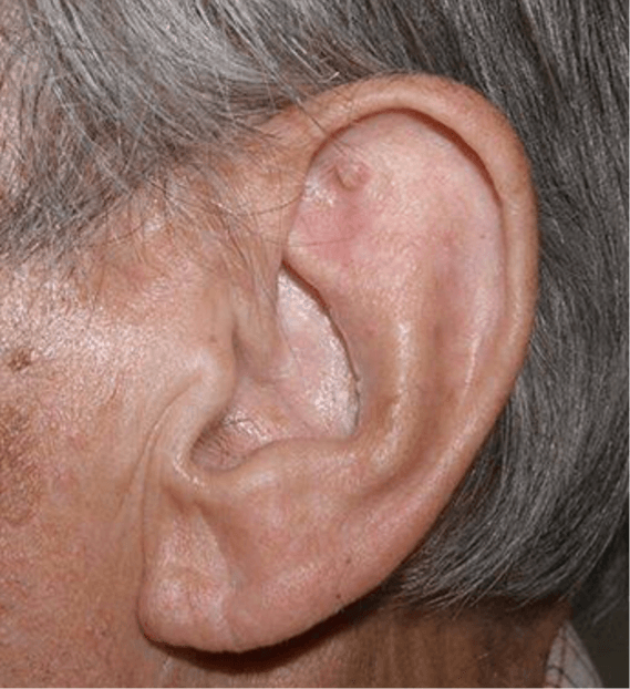 Un primer plano de la oreja de un hombre con cabello gris.