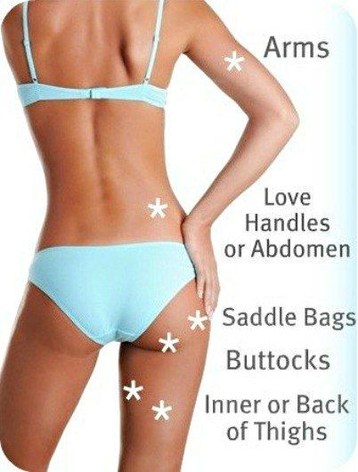 UltraShape-Body-Contouring-Body-Areas