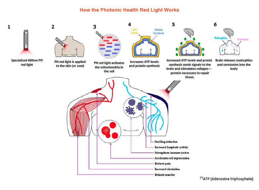 Inergy Photon Laser Therapy illustration