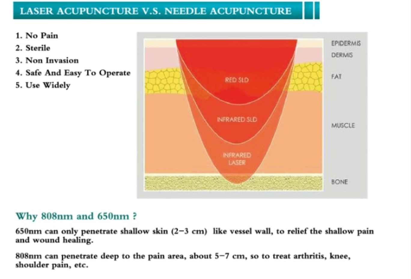 A diagram showing the difference between laser acupuncture and needle acupuncture