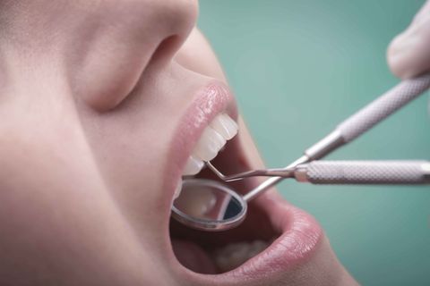 A woman is getting her teeth examined by a dentist.
