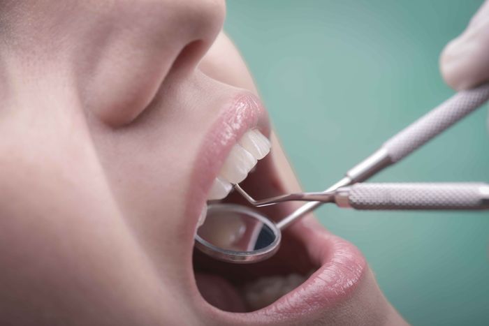A woman is getting her teeth examined by a dentist.