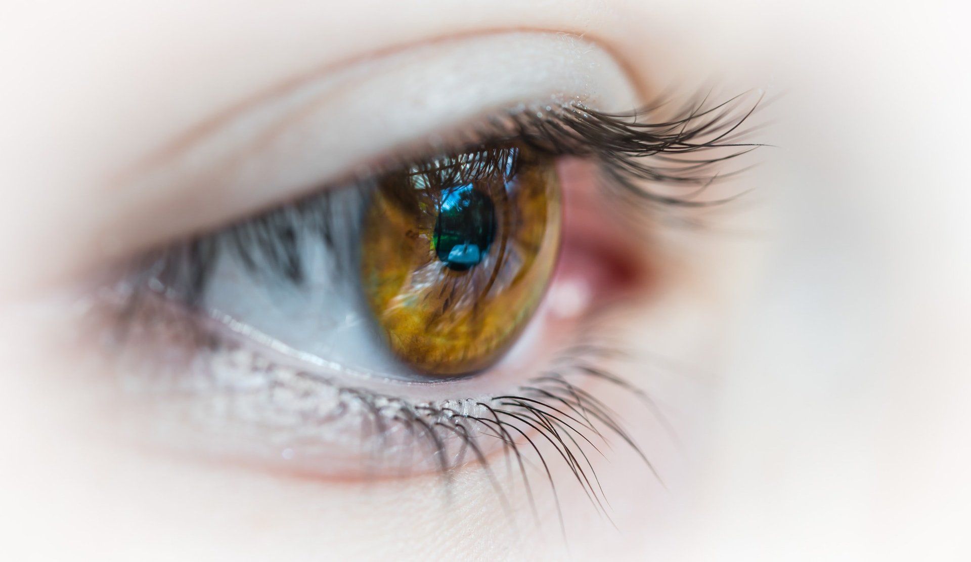 RETINAL DETACHMENT