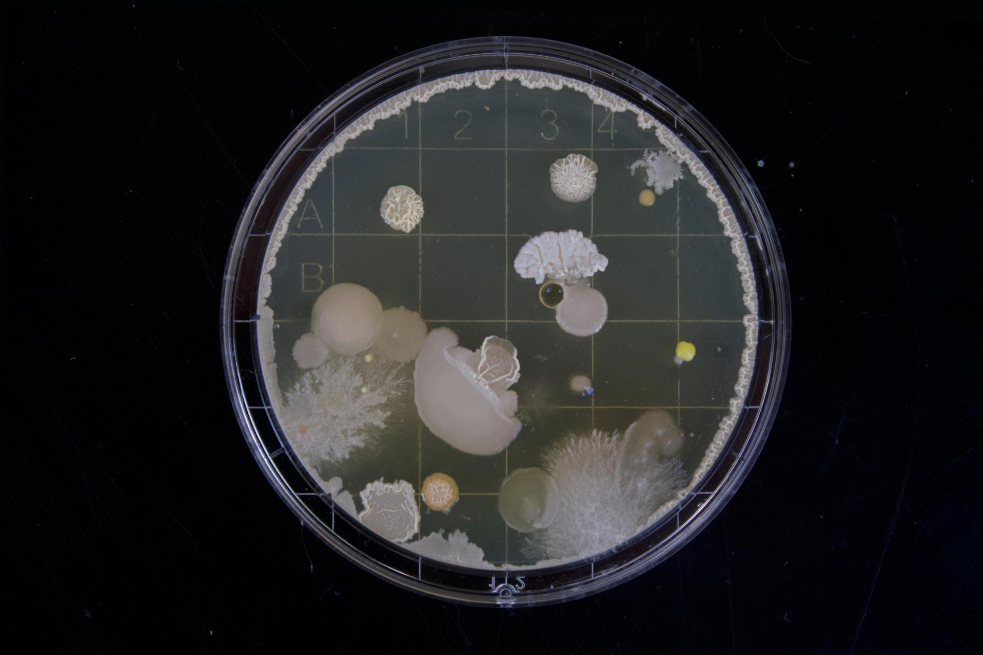 A petri dish filled with bacteria on a black background.