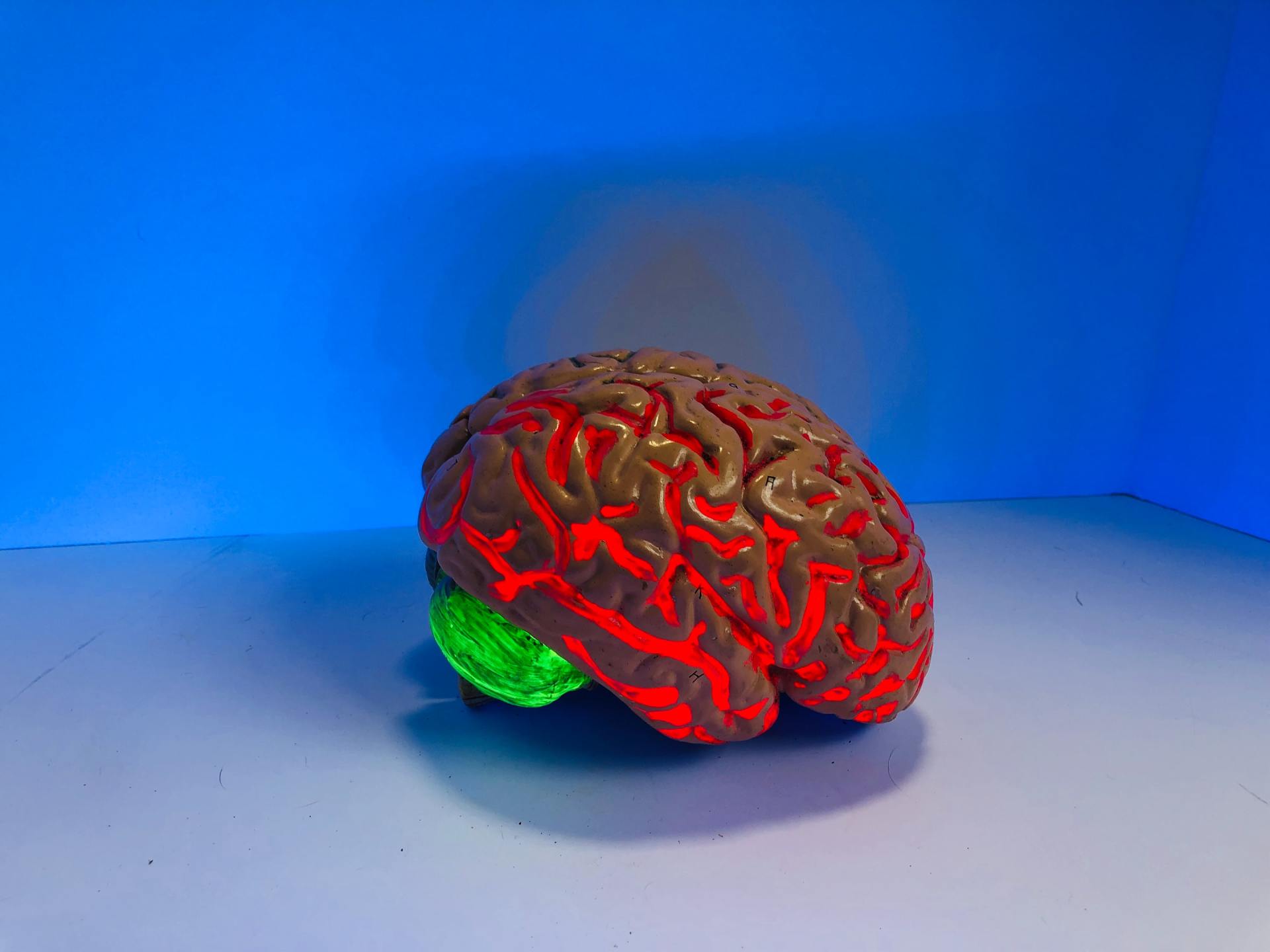 Traumatic Brain Injury