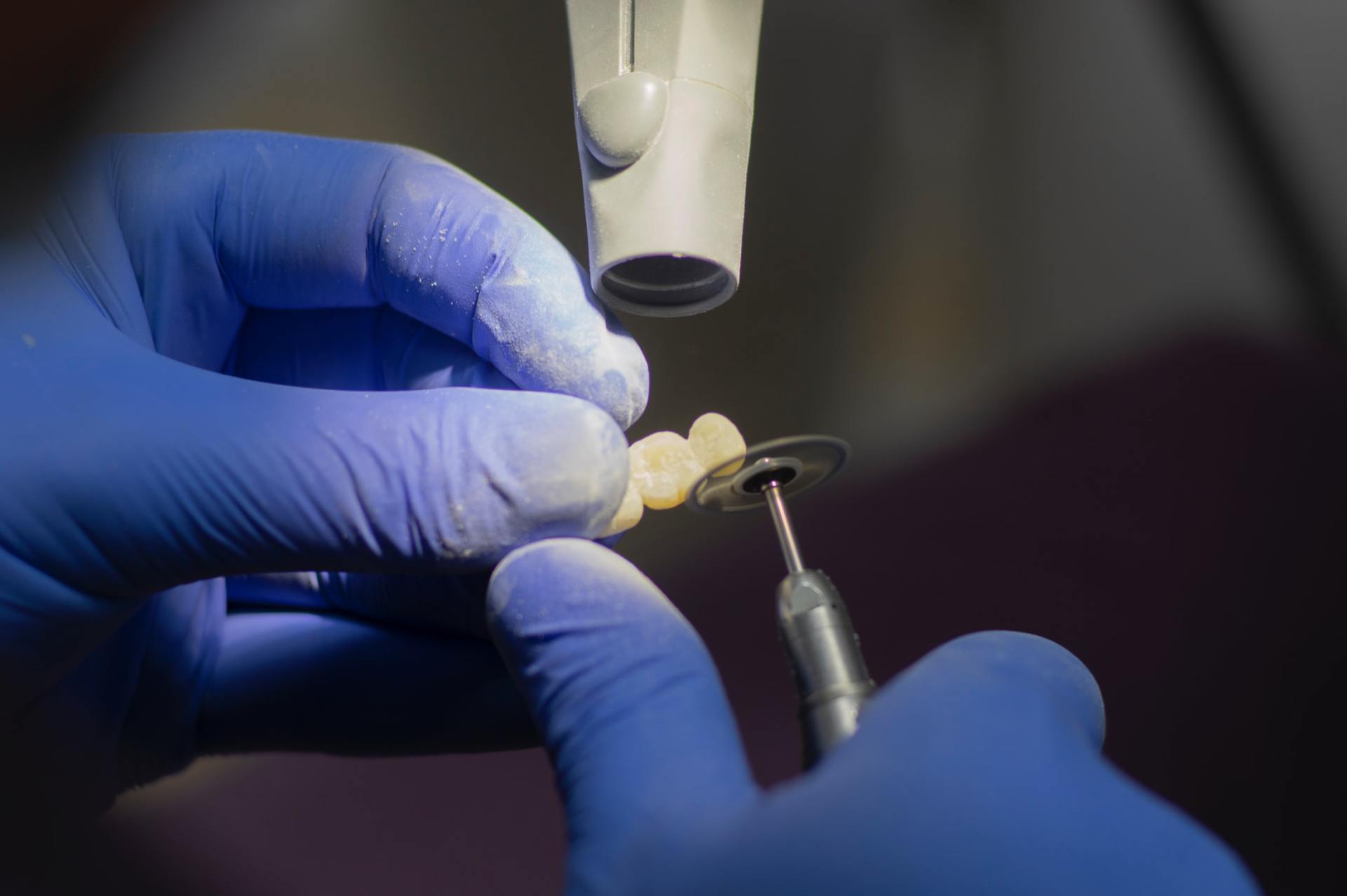 Dental Implants