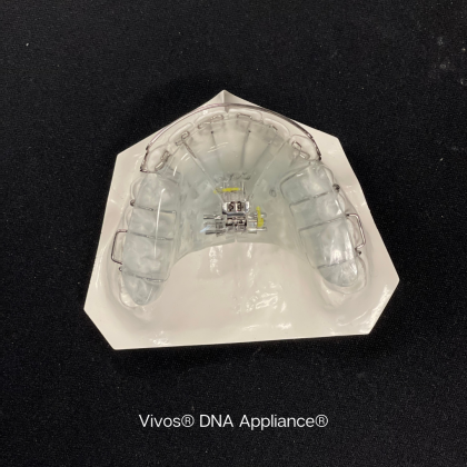 Clear Invisalign aligner on a white model against a black background