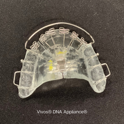 Transparent dental appliance with multiple metal clips on a dark background