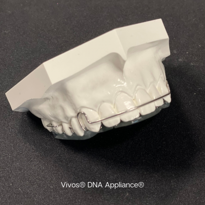 White dental appliance mold on a dark surface, labeled “Vivos® DNA Appliance®”