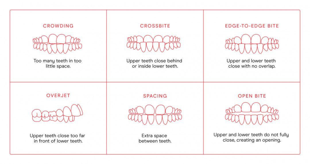 Diagram of mouth and teeth positions for speech sounds, with labeled examples in red and black text.