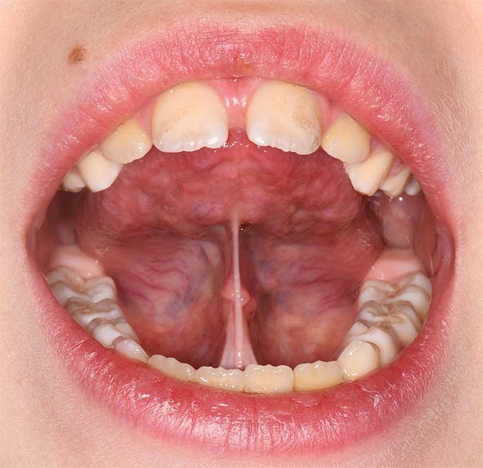 Open mouth showing tongue and palate, with visible upper and lower teeth.
