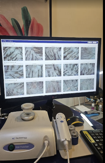 Microscopic scalp analysis screen