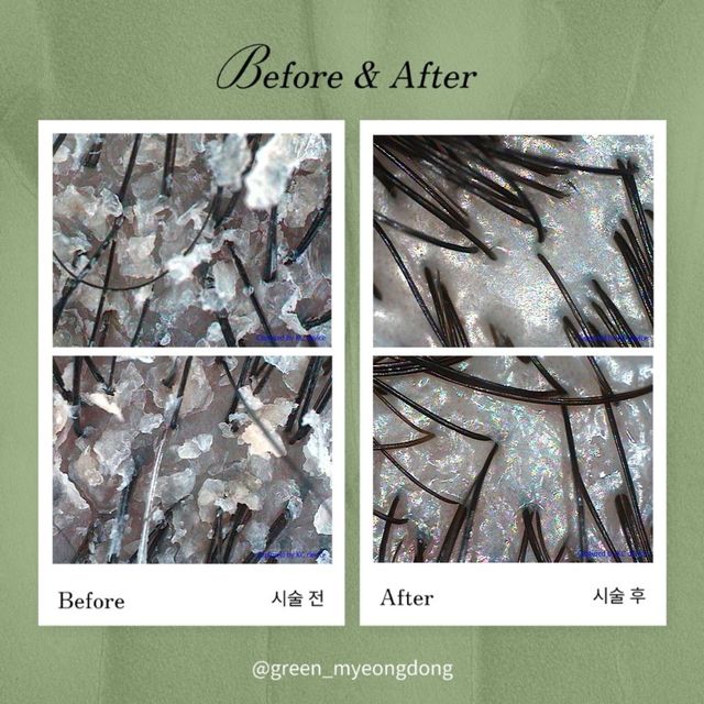 Hair loss care before and after