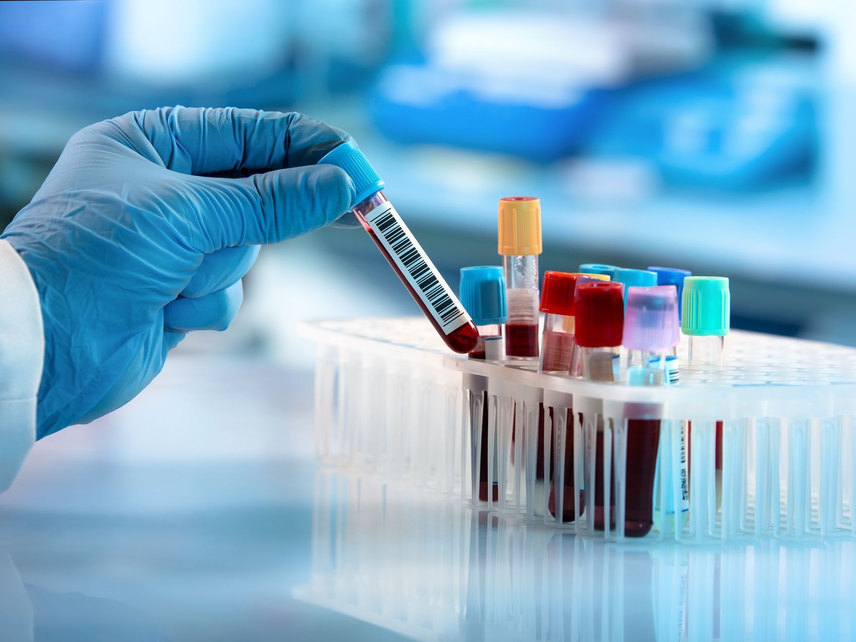 Preimmune Screening