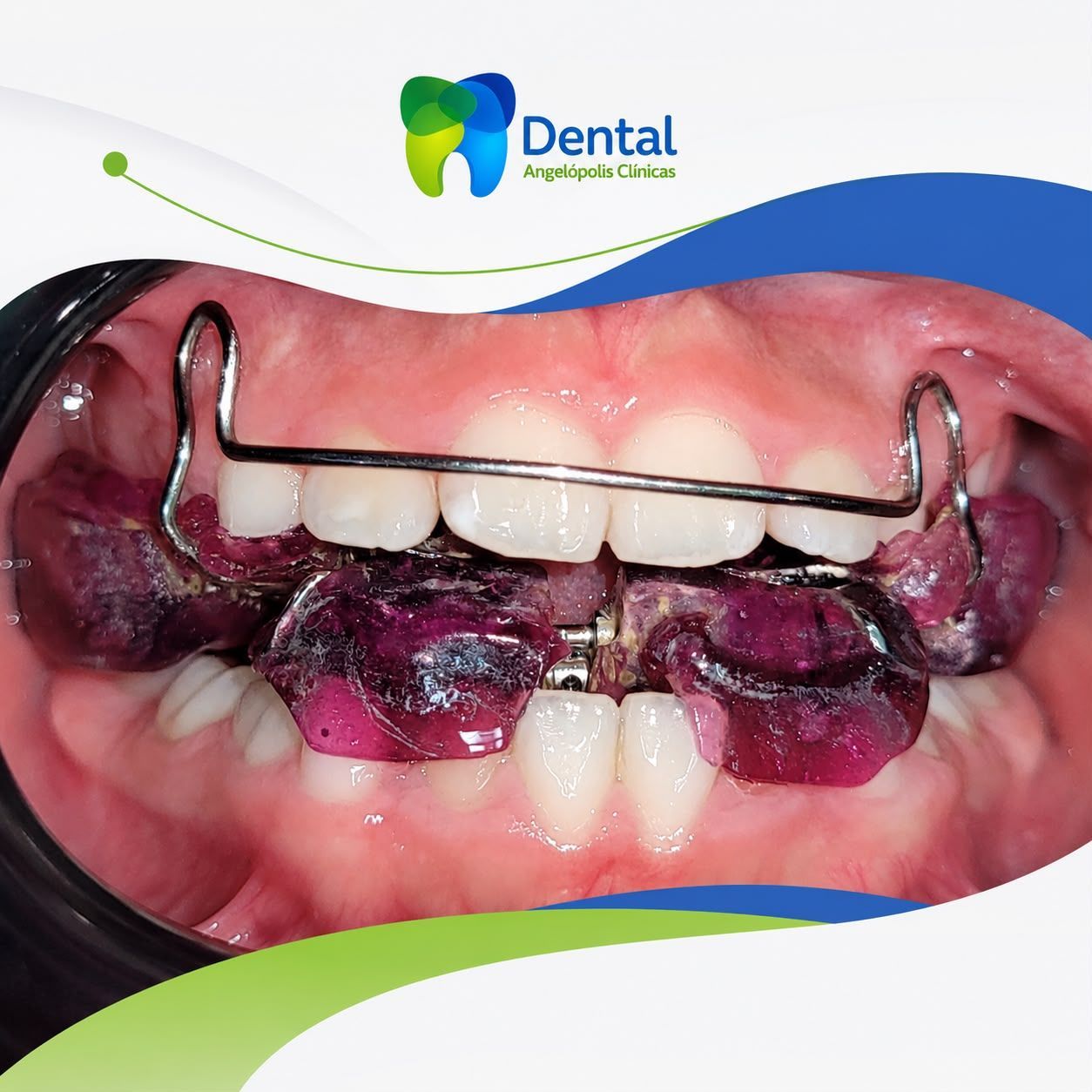 DENTAL ANGELOPOLIS