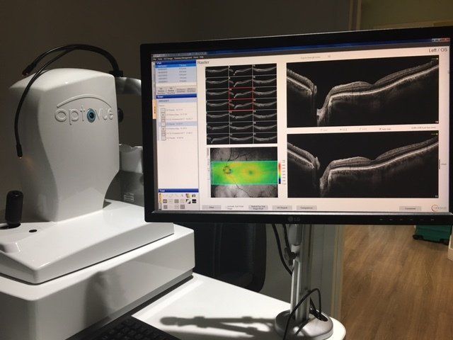 Eye Check-Up — Dixon, CA — Dixon Eyecare Associates