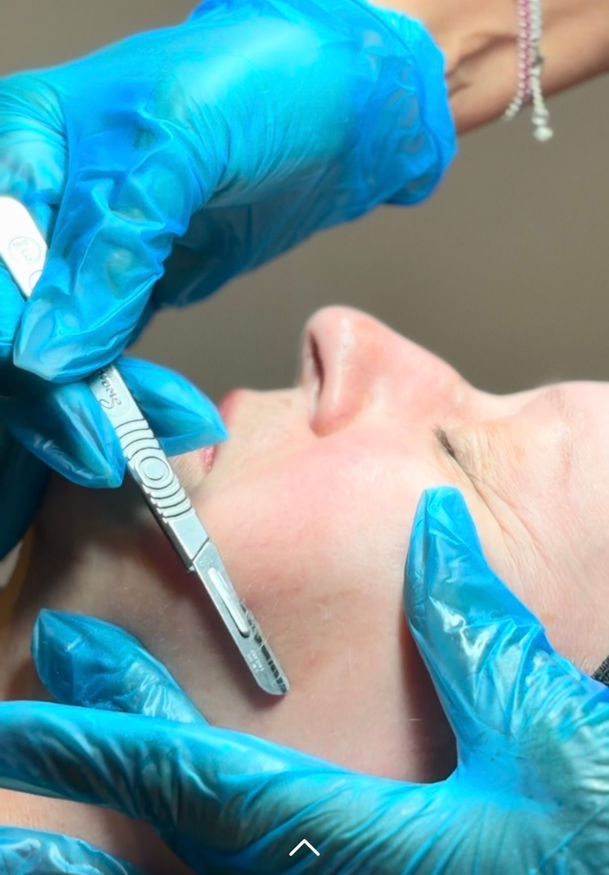 Therapist in blue gloves performing dermaplaning on a client’s cheek at Claws Nail and Beauty