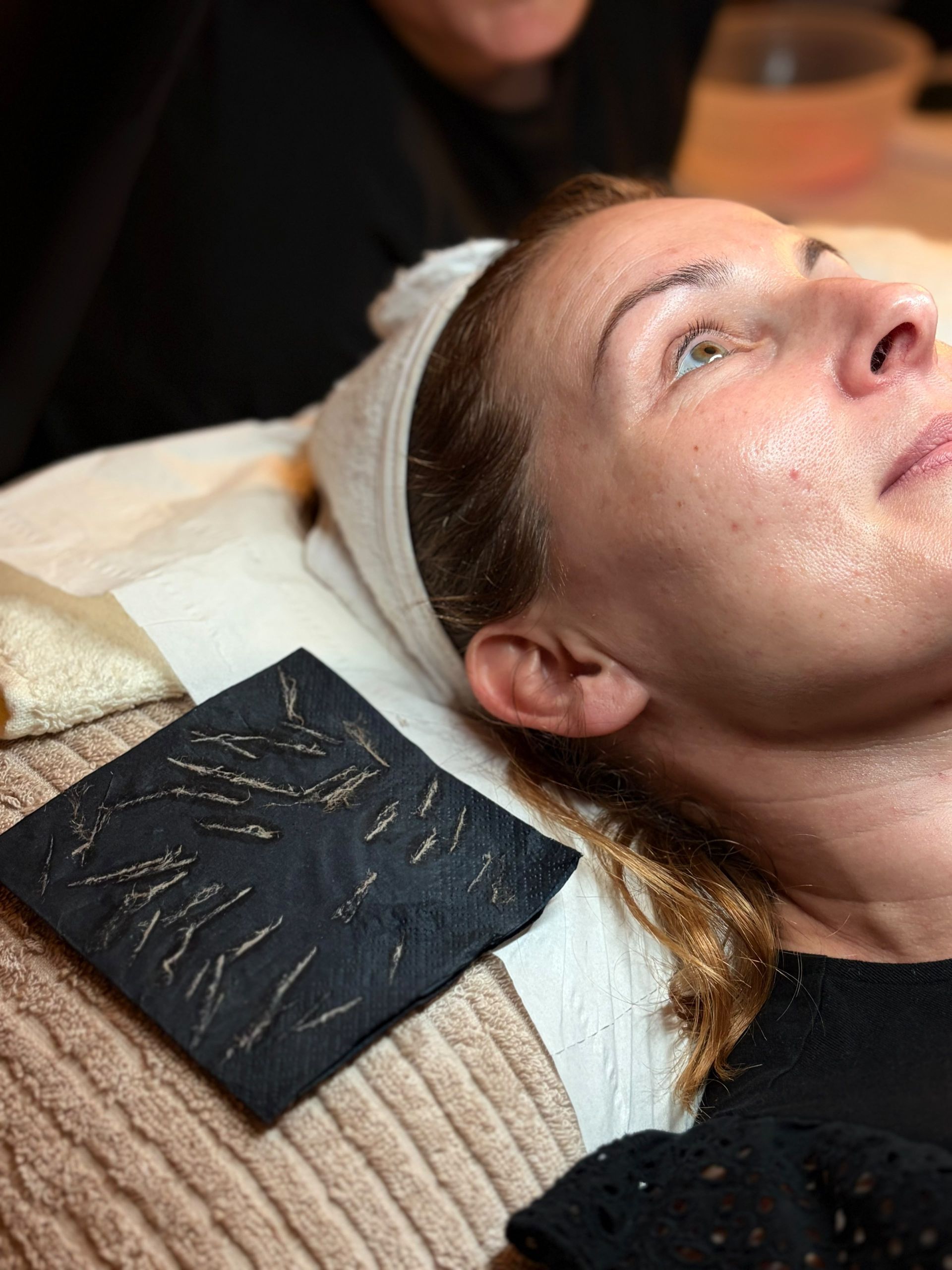 Client wearing a headband lying beside a black card covered in fine hair and dead skin removed by dermaplaning