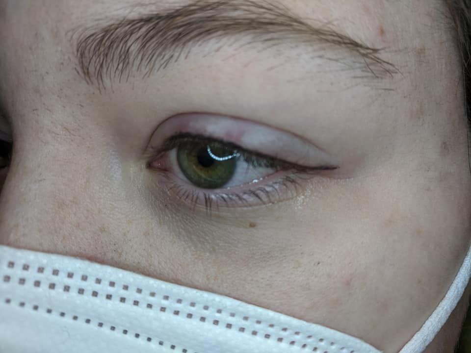 Close-up of a person’s eye above a white face mask, looking to the side