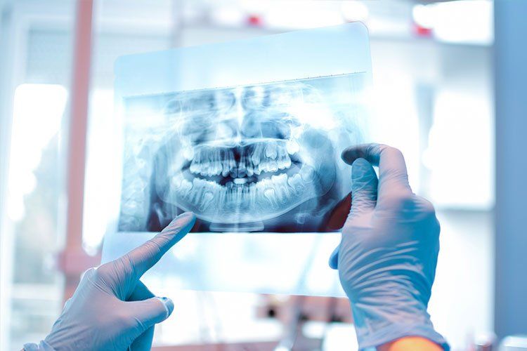 A dentist is holding an x-ray of a person 's teeth.