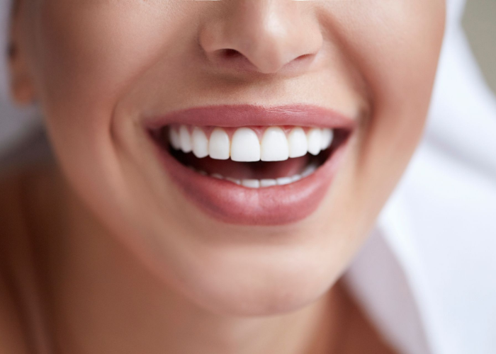 Close-up of a smiling mouth with white teeth and pink lips.