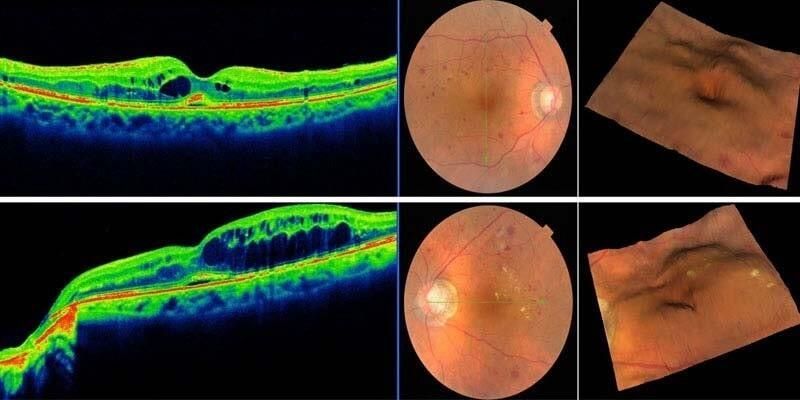 OCULASER CLÍNICA OFTALMOLÓGICA 