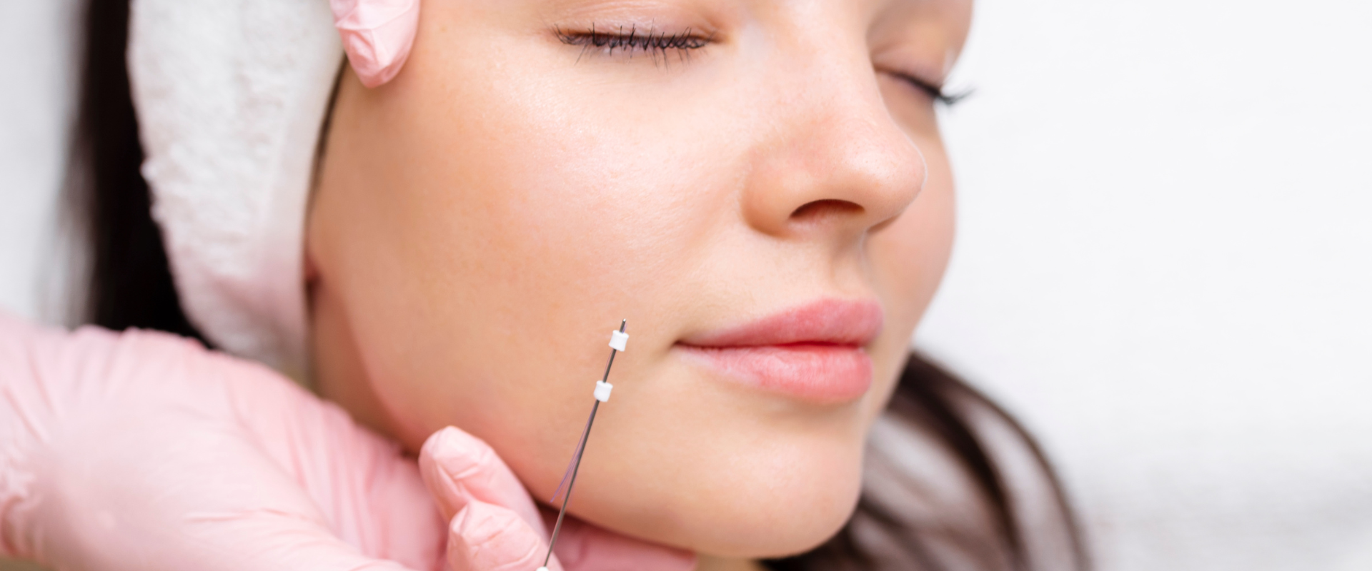 Face Threading for Jowls and Double Chin