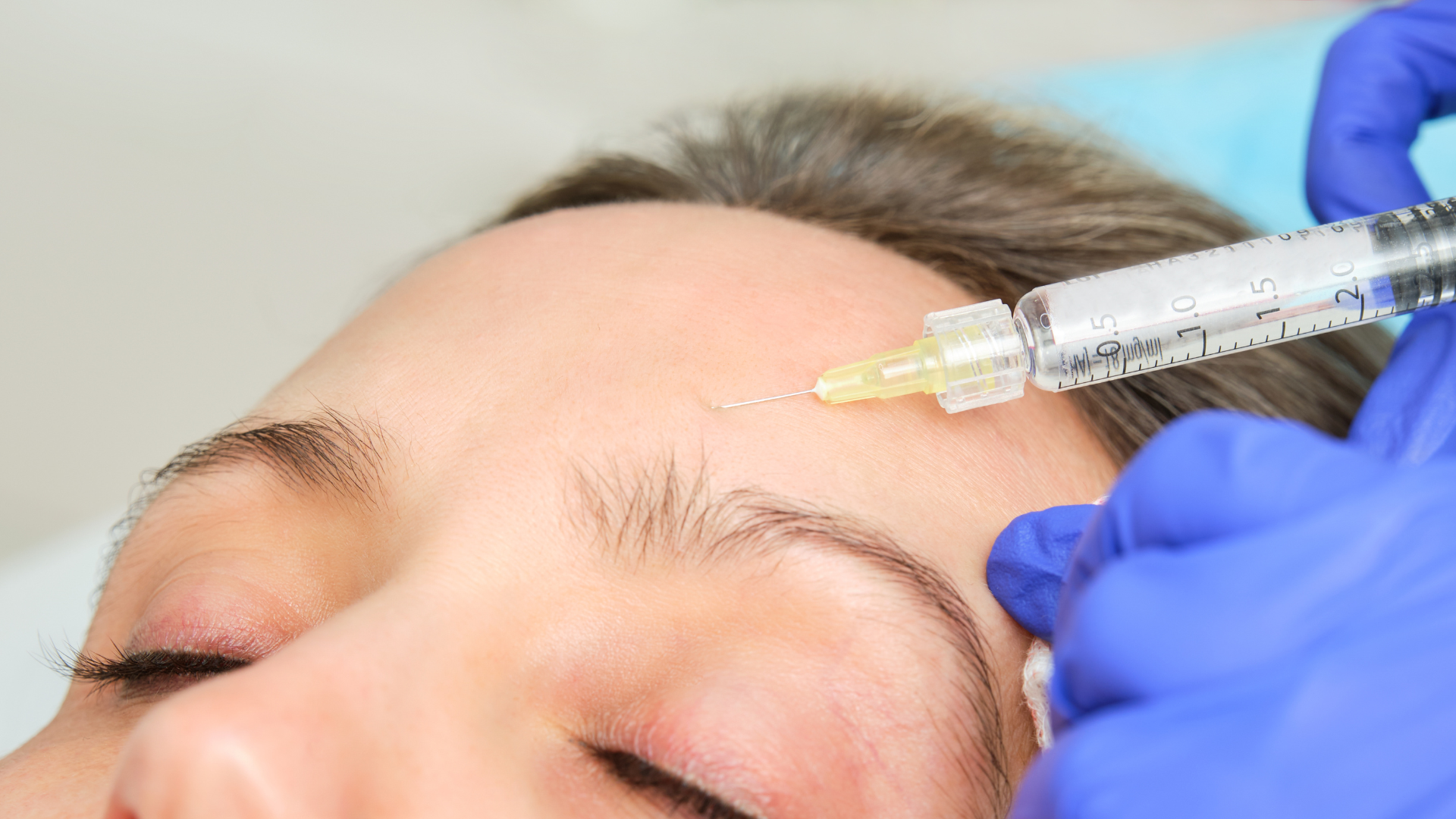 Patient being numbed before PDO thread lift