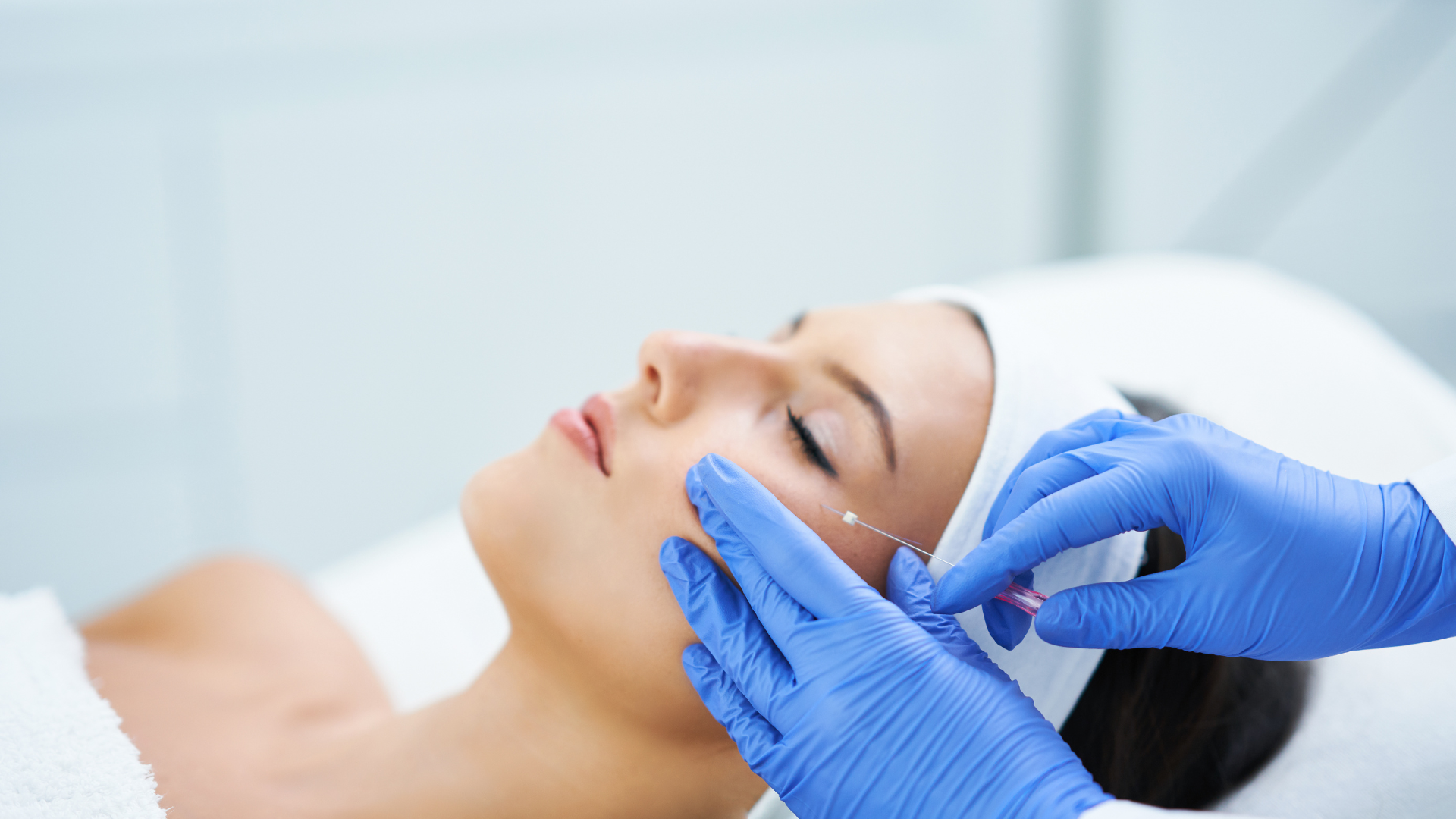 PDO Thread lift procedure on patient