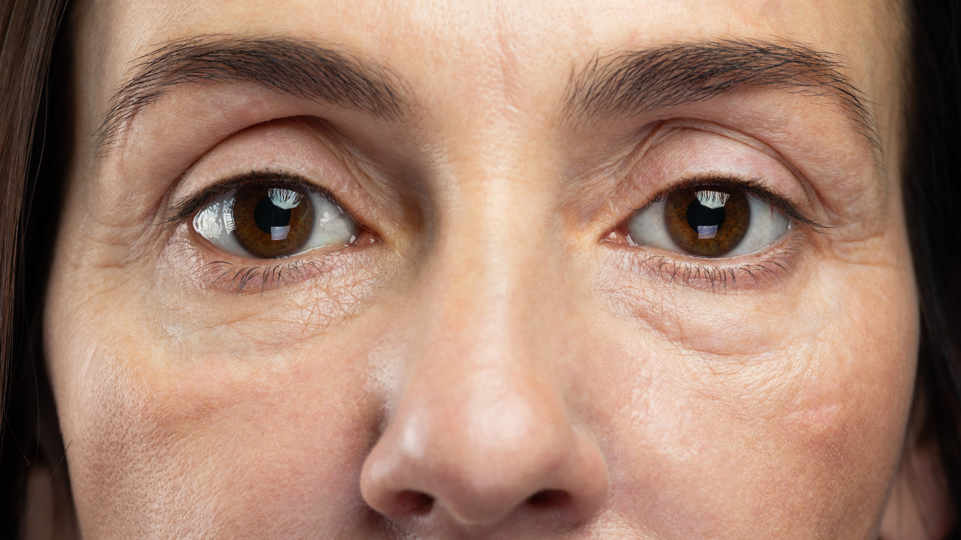 Up close look on eyebrows, preparing for PDO thread lift