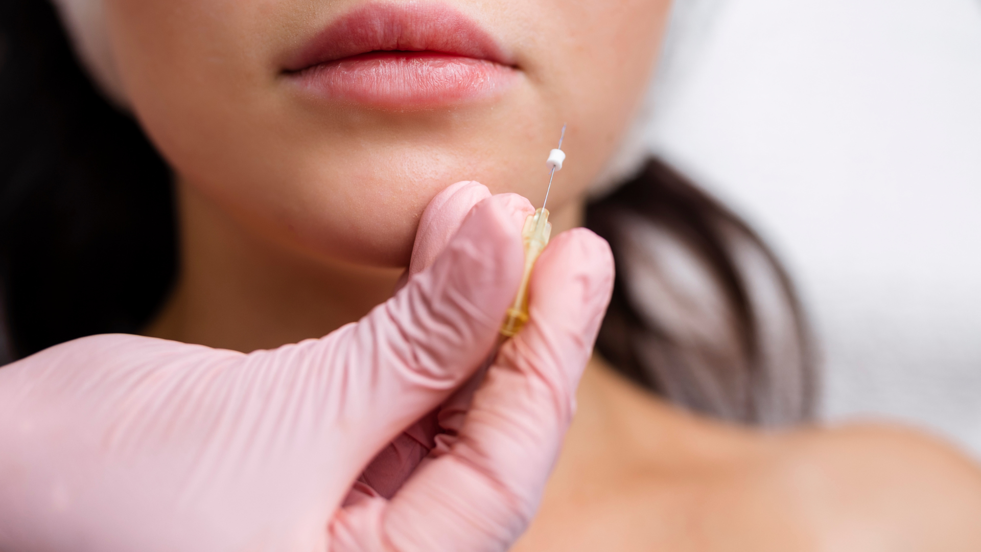 Woman getting pdo thread lift for lips