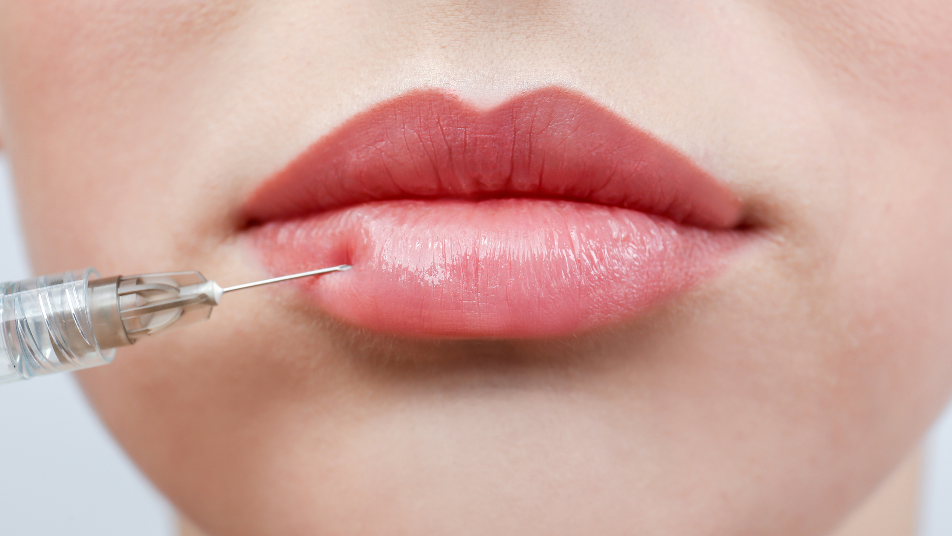 Woman getting lip filler