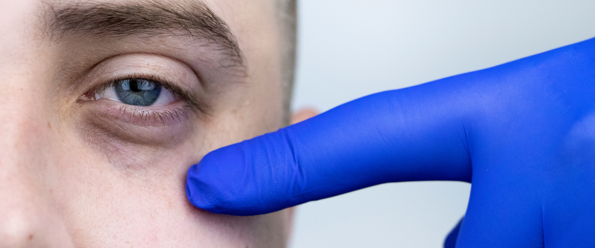 A man with eye bags and his doctor prepare for eye thread lift procedure