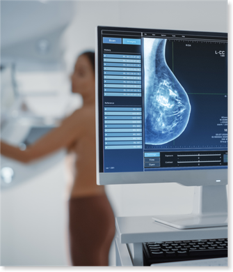 Uma mulher está fazendo uma mamografia na tela do computador