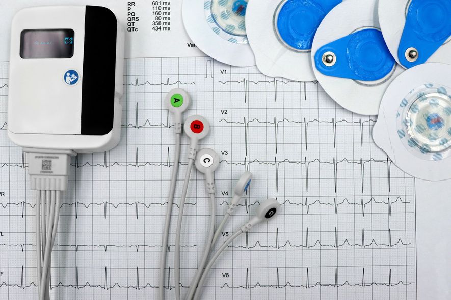 Sensori medicali e grafico ECG con monitor cardiaco, cavi e dischi blu su una superficie bianca