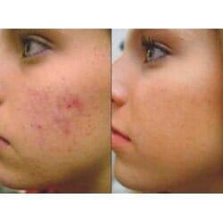 DR. HILDORFO GENCHI SOLÍS – DERMATITIS DE CONTACTO