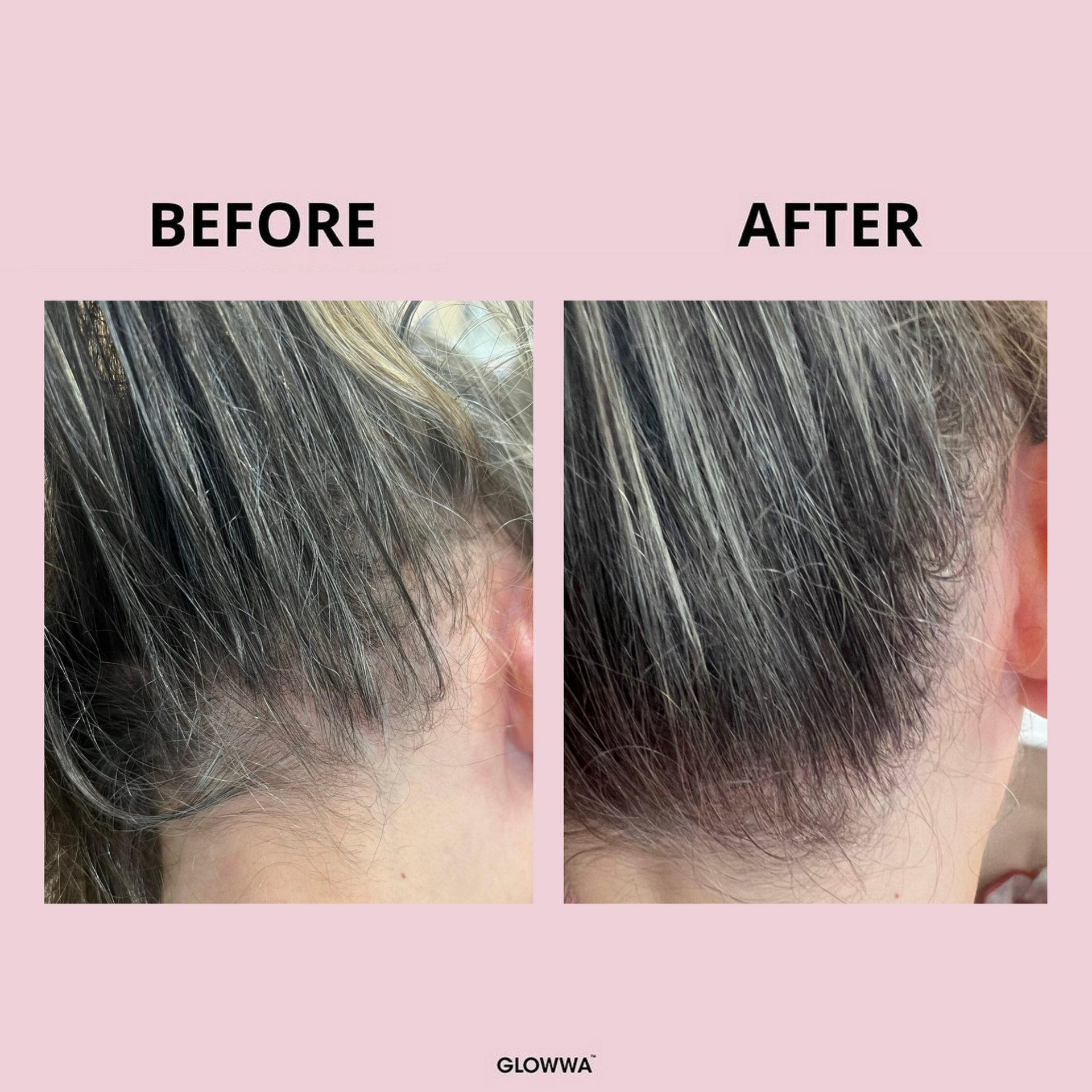 Before and after picture of GLOWWA Hair Food showing improved hair thickness and condition