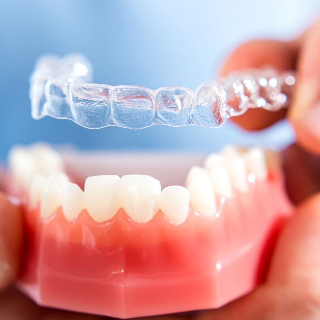 Invisalign in Beachwood Ohio