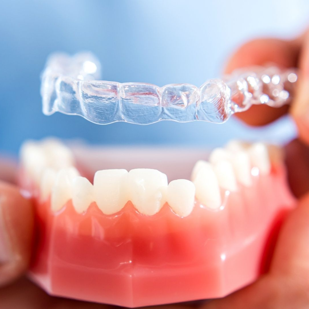 Invisalign treatment in Shaker Heights Ohio
