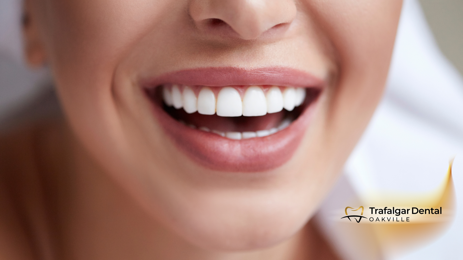 A close up of a woman 's smile with white teeth.