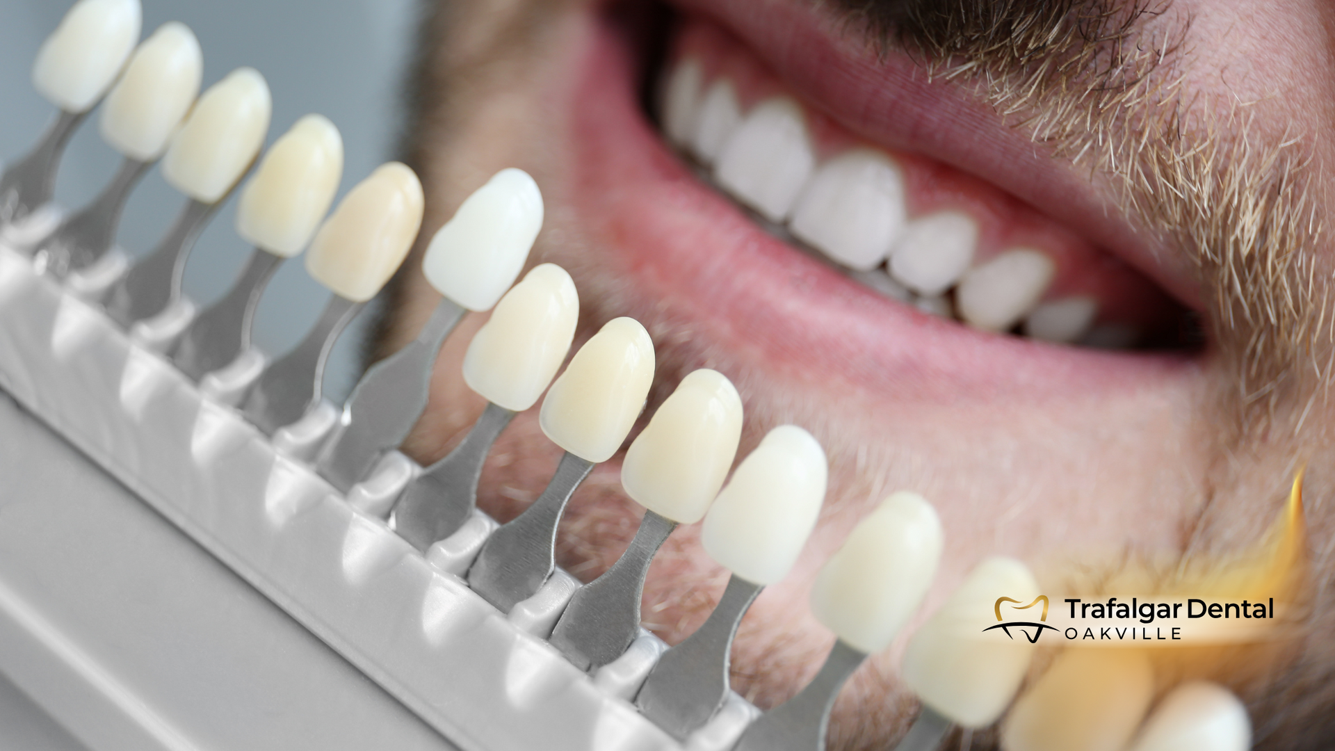 A close up of a man 's teeth next to a tooth color chart